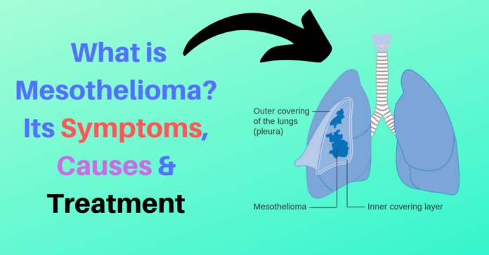 What is Mesothelioma_ Its Symptoms, Causes & Treatment